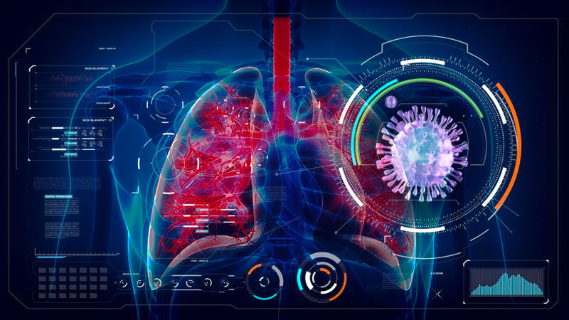 Artificial Intelligence Tool Predicts Which Coronavirus Patients Get Deadly 'Wet Lung' (i2tutorials)